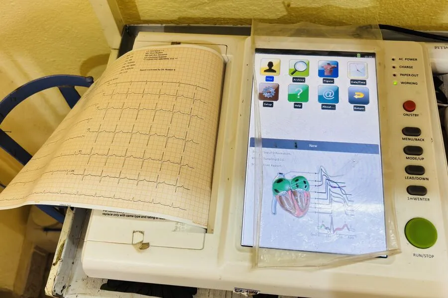 ECG report printout
